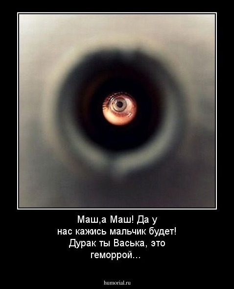 Маш,а Маш! Да у нас кажись мальчик будет! Дурак ты Васька, это геморрой... 