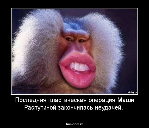 Последняя пластическая операция Маши Распутиной закончилась неудачей.