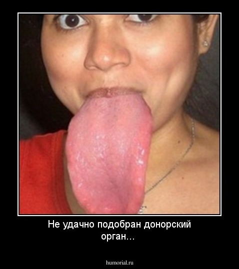 Не удачно подобран донорский орган...