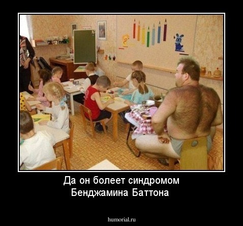 Да он болеет синдромом Бенджамина Баттона 