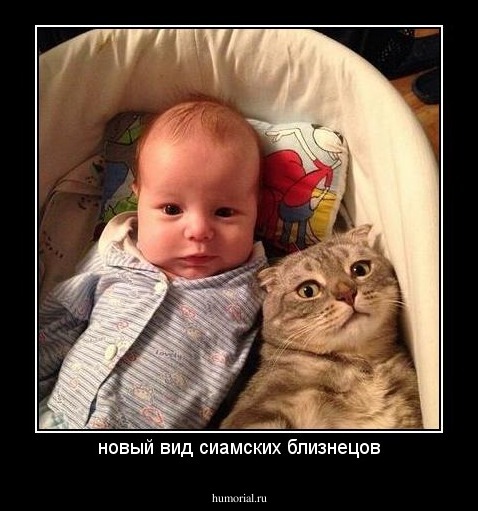 новый вид сиамских близнецов