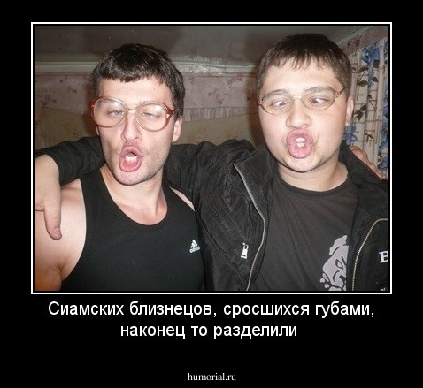 Сиамских близнецов, сросшихся губами, наконец то разделили