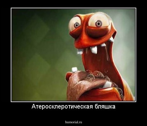 Атеросклеротическая бляшка