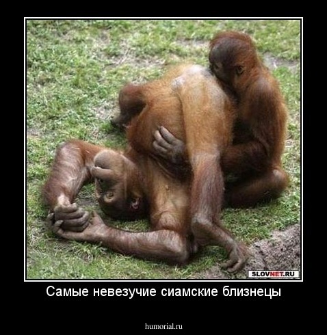 Самые невезучие сиамские близнецы