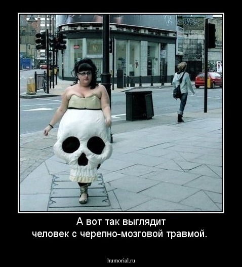 А вот так выглядит человек с черепно-мозговой травмой.