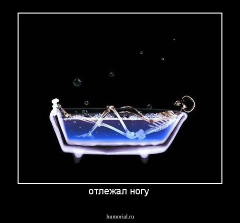 отлежал ногу 