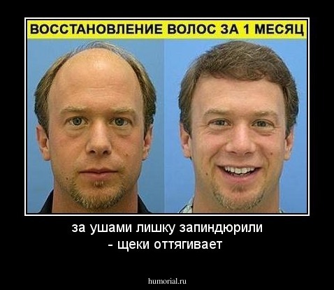 за ушами лишку запиндюрили - щеки оттягивает