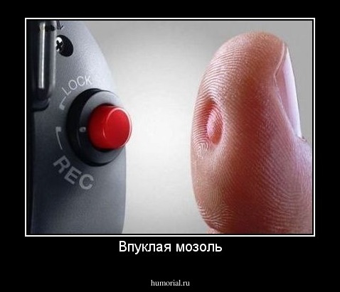 Впуклая мозоль
