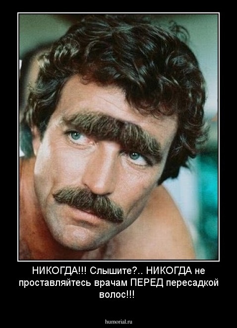 НИКОГДА!!!   Слышите?.. НИКОГДА не проставляйтесь врачам ПЕРЕД пересадкой волос!!! 