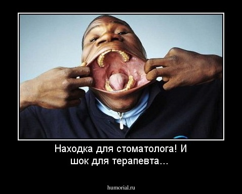 Находка для стоматолога! 

И шок для терапевта...