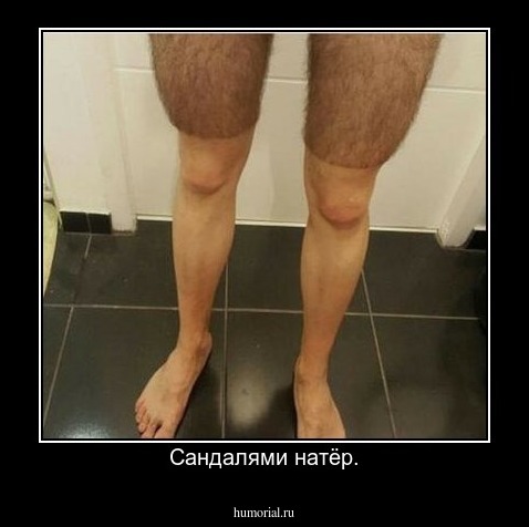Сандалями натёр.