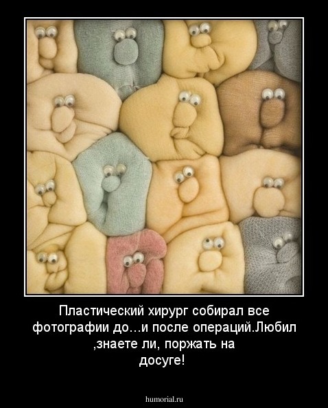 Пластический хирург собирал все фотографии до...и после операций.Любил ,знаете ли, поржать на досуге!
