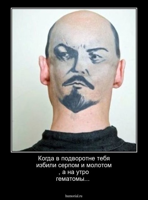 Когда в подворотне тебя избили серпом и молотом , а на утро гематомы...