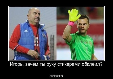 Игорь, зачем ты руку стикерами обклеил?