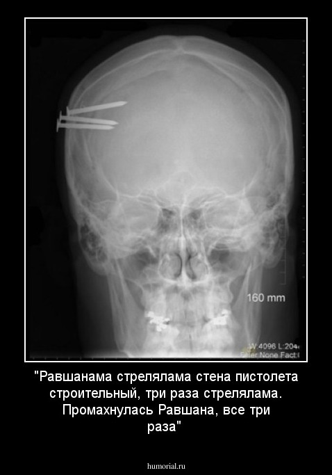 "Равшанама стрелялама стена пистолета строительный, три раза стрелялама. Промахнулась Равшана, все три раза"
