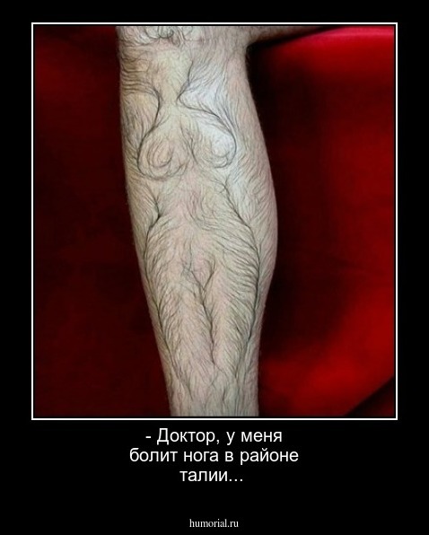 - Доктор,  у меня болит нога в районе талии...