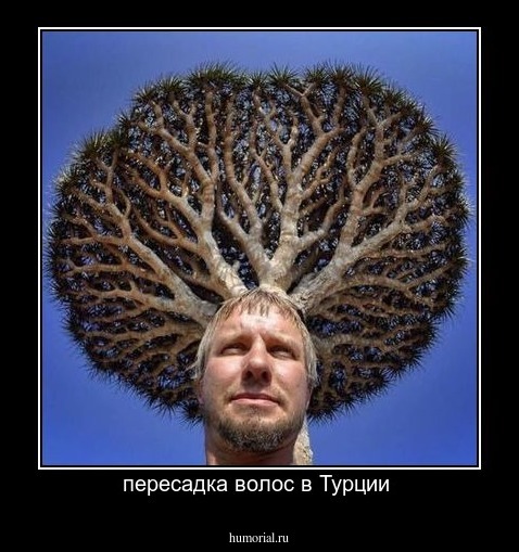 пересадка волос в Турции 