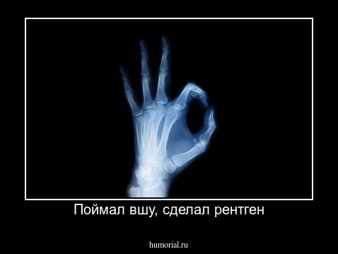 Поймал вшу, сделал рентген
