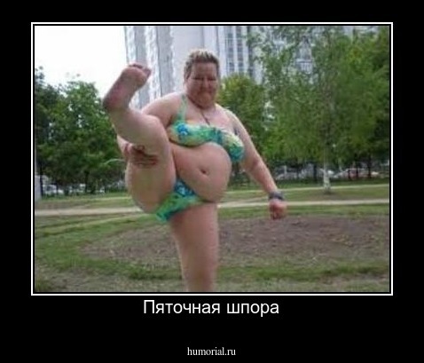Пяточная шпора