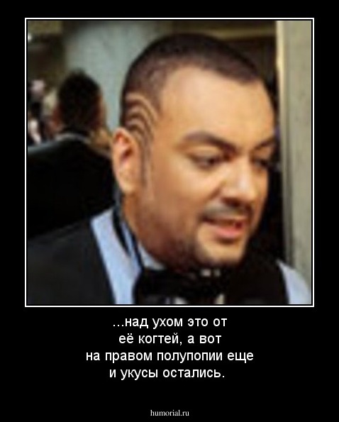 ...над ухом это от её когтей, а вот на правом полупопии еще и укусы остались.
