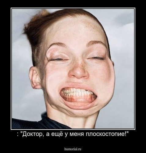  : "Доктор, а ещё у меня плоскостопие!"