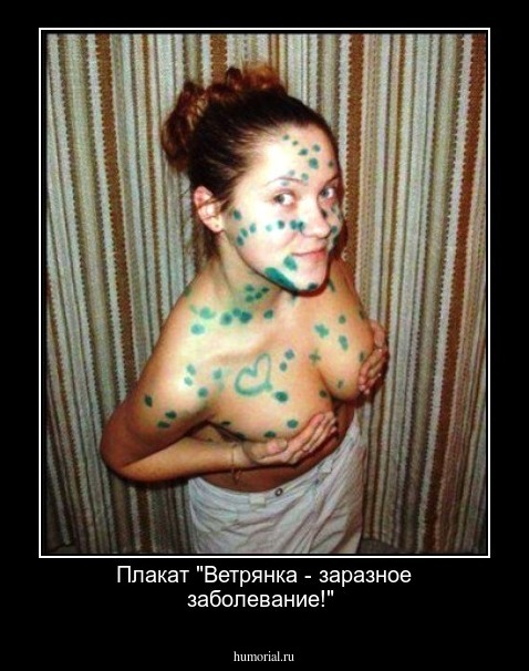 Плакат "Ветрянка - заразное заболевание!"