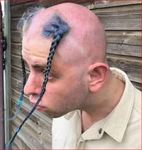 Откосил от армии.