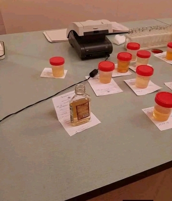 для лаборанта и врача - вот Петровича моча