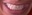 U586_thumb